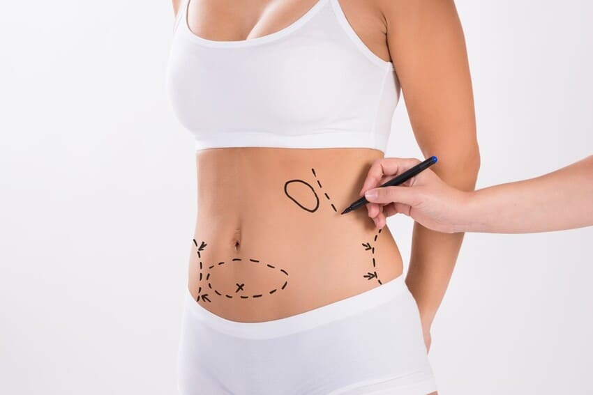 prezzo-liposuzione-bodytite-turchia-cheap